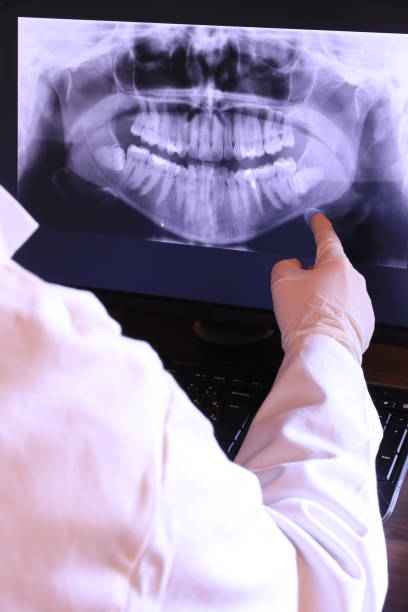 Best Emergency Wisdom Teeth Removal in Waverly, IA